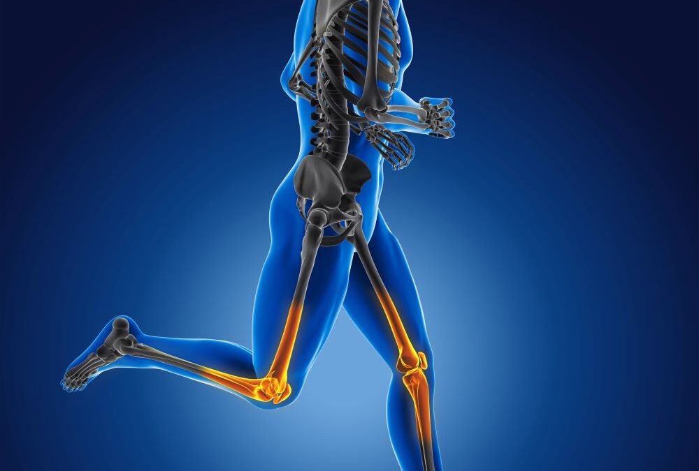 Is Recovery Time Faster For Robotic Knee Replacement?