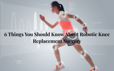 6 Things You Should Know About Robotic Knee Replacement Surgery.