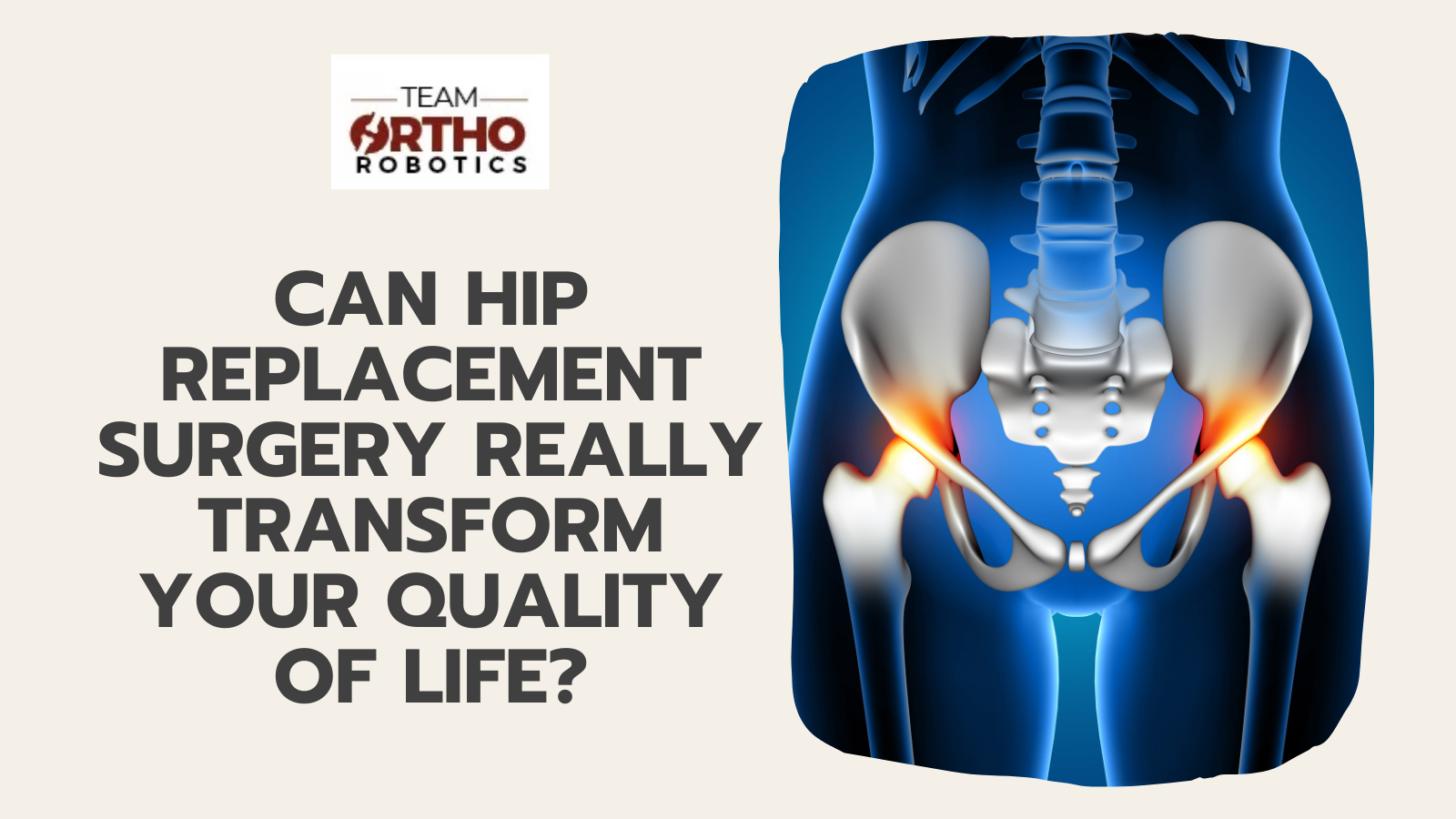 Can Hip Replacement Surgery Really Transform Your Quality of Life?