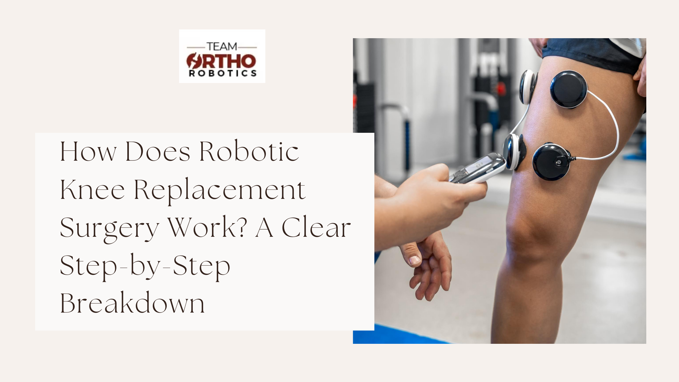 How Does Robotic Knee Replacement Surgery Work? A Clear Step-by-Step Breakdown