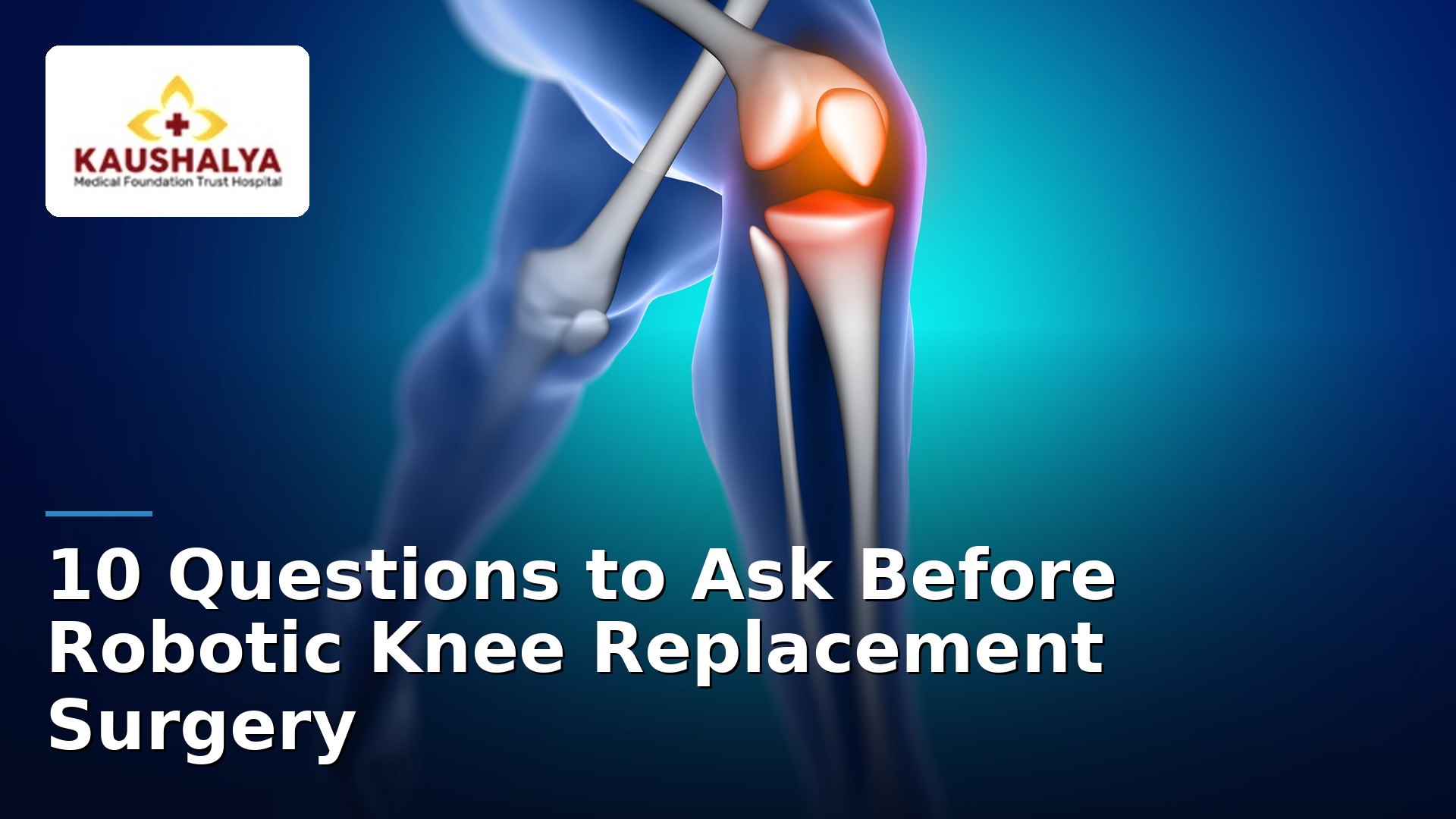 10 Questions to Ask Before Robotic Knee Replacement Surgery